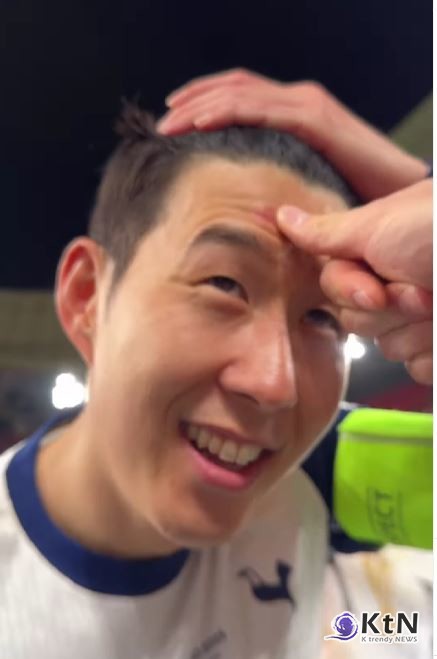  손흥민, '유로파리그 우승'… 트로피에 이마 긁히며 ‘영광의 상처’  [영상]  사진=2025 05.22  spursofficial  K trendy NEWS DB ⓒ케이 트렌디뉴스 무단전재 및 수집, 재배포금지