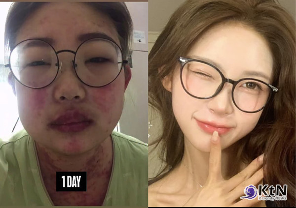 최준희 “밤마다 컵라면 6개”…96kg→41kg, 루프스 투병 고백 사진=2025 05.23 최준희 인스타그램 갈무리  K trendy NEWS DB ⓒ케이 트렌디뉴스 무단전재 및 수집, 재배포금지