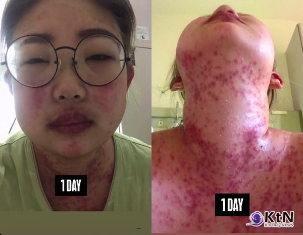 최준희 “밤마다 컵라면 6개”…96kg→41kg, 루프스 투병 고백 사진=2025 05.23 최준희 인스타그램 갈무리  K trendy NEWS DB ⓒ케이 트렌디뉴스 무단전재 및 수집, 재배포금지