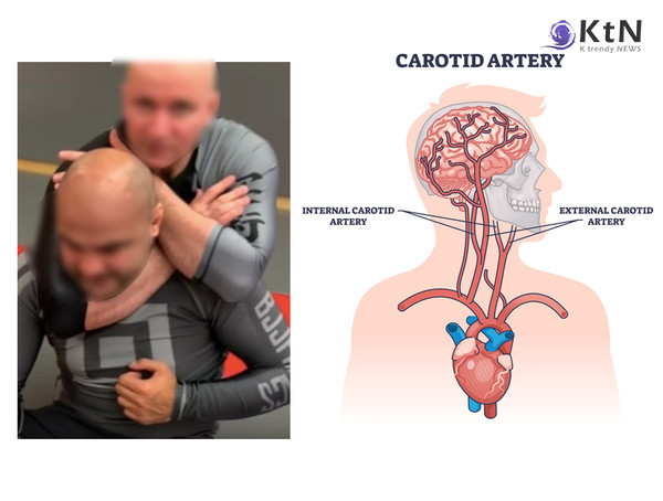 아들 앞 기절했는데 또 주먹질…故 김창민 감독을 죽음으로 몬 '백초크'의 공포   사진=2026. 04.02  VectorMine - Getty Images K trendy NEWS DB ⓒ케이 트렌디뉴스 무단전재 및 수집, 재배포금지