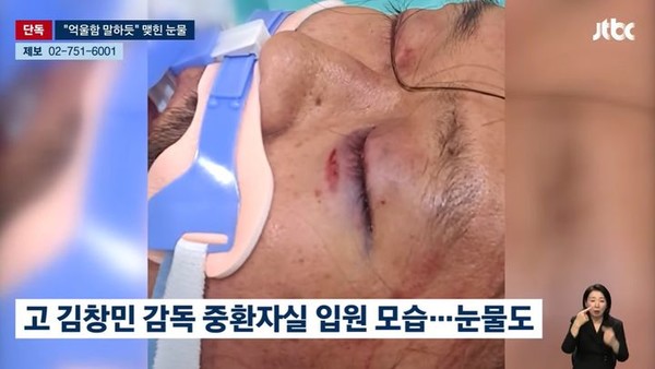  JTBC ‘뉴스룸’이 공개한 故 김창민 감독의 응급실 사진이 사건을 다시 수면 위로 끌어올린 가운데, 유족은 “원점 재조사”를 요구하며 사건 전반의 진상 규명을 촉구했다. 사진=2026. 04.07 JTBC ‘뉴스룸’ K trendy NEWS DB ⓒ케이 트렌디뉴스 무단전재 및 수집, 재배포금지
