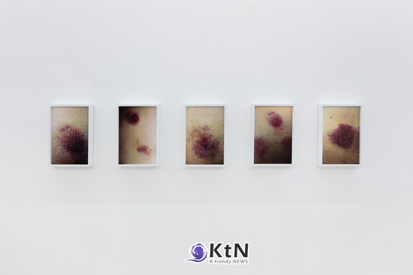 뉴욕 마켓 갤러리와 멕시코시티 서드 본의 공동전에 설치된 사진 다섯 점. 피부를 가까이 촬영한 이미지들을 같은 크기의 흰색 액자에 넣어 일정한 간격으로 배열했다. 사진=@hiperfocal.arte, THIRD BORN·Market Gallery 제공